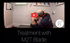 Amazing IASTM Results! - Shoulder Treatment with M2T-Blade
